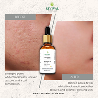 Pore Perfecting & Oil Balance Duo