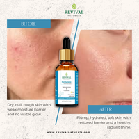 Hyaluronic Acid Face Serum (Plump)