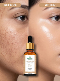 Glow Fix Lightening Ampule