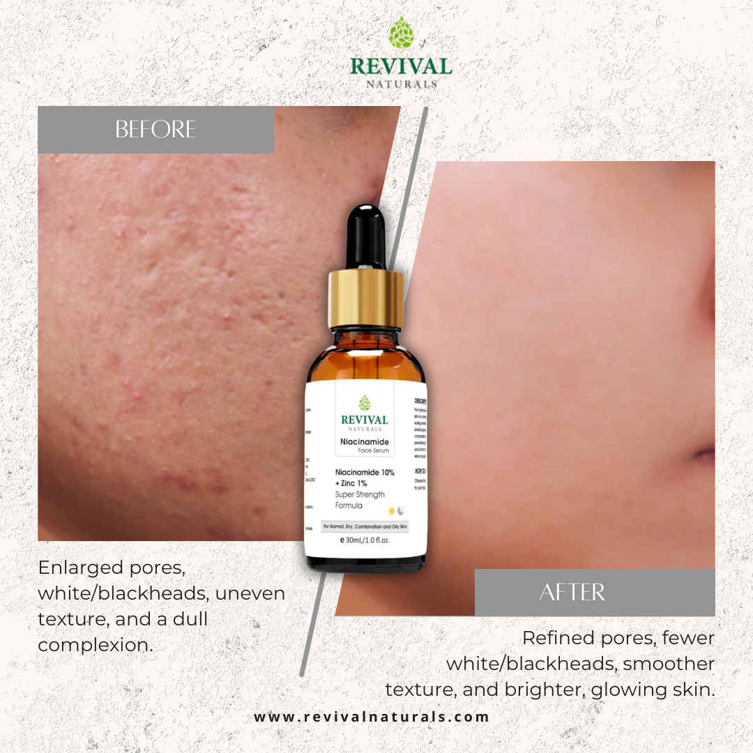 Pore Perfecting & Oil Balance Duo