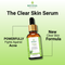 Anti-Acne Face Serum (Clear Skin)